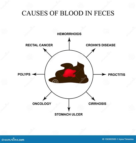 Causas De La Sangre En Heces Enfermedades Del Aparato Gastrointestinal