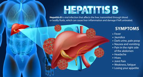 Hepatitis B Symptoms