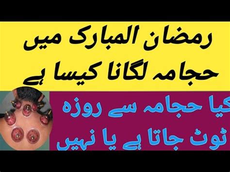 Benefits Of Hijama In Ramadan Hijama Say Roza Kharab To Nahi Hota