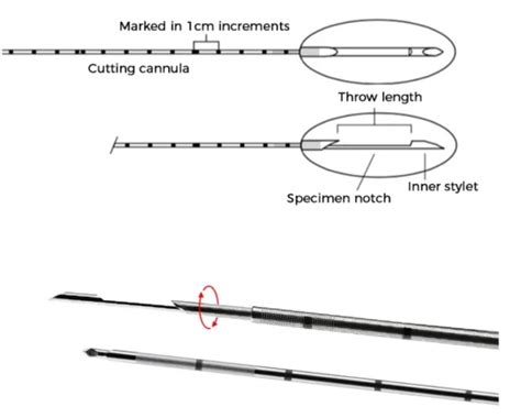 Abrams Pleural Biopsy Needle 4mm Extra Diameter Cardiovascular Needle