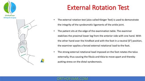 Ankle External Rotation Test | OrthoFixar 2025