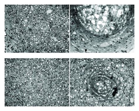 Photomicrographs Showing Regenerated Nerve Cross Sections Of A