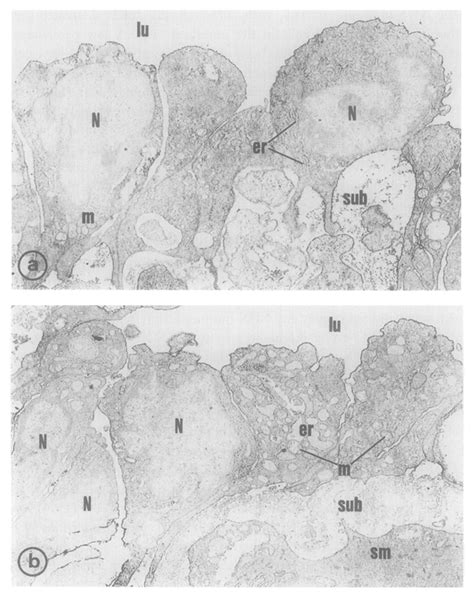 Electron Micrograph Of The A Umbilical Artery And B Umbilical Vein