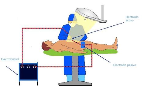 Curso electrobisturís Apuntes de Electromedicina Xavier Pardell