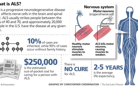 What Is Lou Gehrig's Disease? - oggsync.com