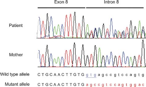 Identification Of A Novel Heterozygous Mutation In The WDR45 Gene