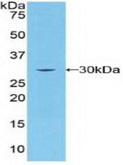 BRCA2 Polyclonal Antibody Invitrogen 20 μL Unconjugated Fisher