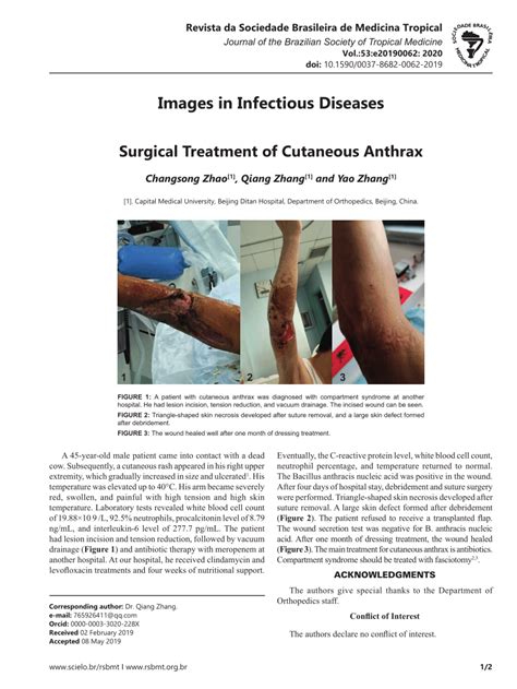 (PDF) Surgical Treatment of Cutaneous Anthrax