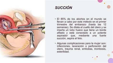 BioÃtica y el Aborto pptx