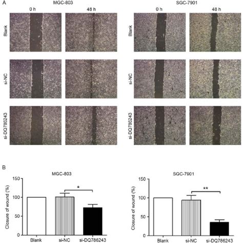 In Vitro Wound Healing Assay Of Gc Cells A Representative