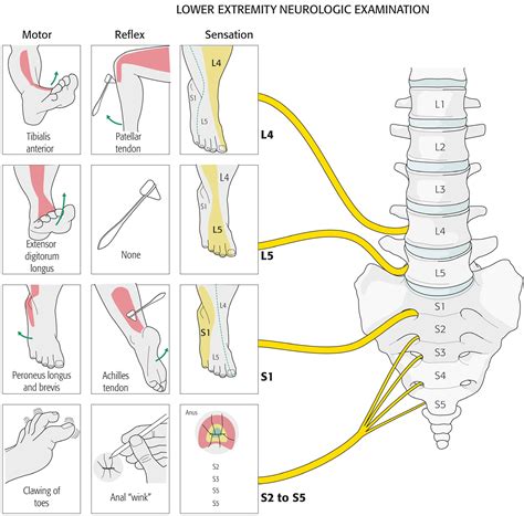 Back Pain Simplified Spinepain Solutions