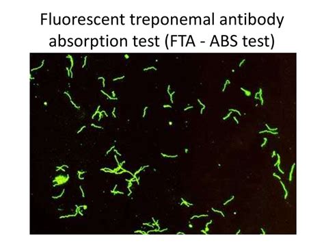 Serology Immunity Reactions Agglutination Precipitation And