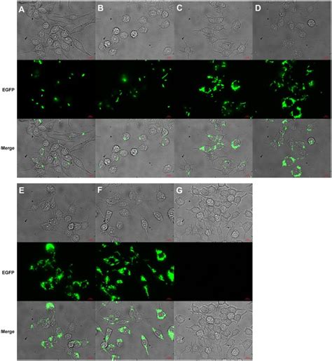 Shifts In The Fluorescence Lifetime Of Egfp During Bacterial