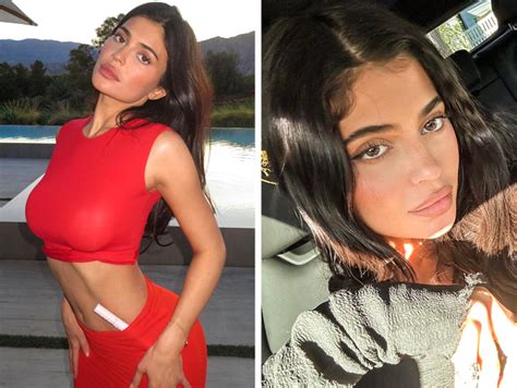 Kylie Jenner Shuts Down Rumors That Shes Had Too Much Surgery On Her