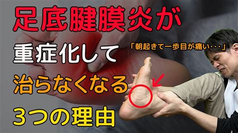 【足底腱膜炎治し方】足底腱膜炎でやってはいけないストレッチと足底筋膜炎を改善する方法【重症】 Youtube