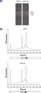 RNeasy Fibrous Tissue Mini Kit | RNA Isolation | QIAGEN