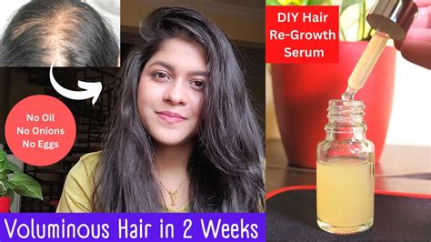 इसे दिन में बस दो बार लगाने से हमेशा के लिए बाल काले घने मज़बूत हो जायेंगे Diy Hair Growth