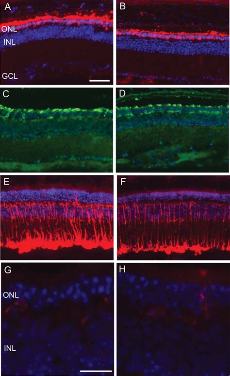 Systemic RAAV EpoR76E Has No Effect On Opsin Localization Or Glial