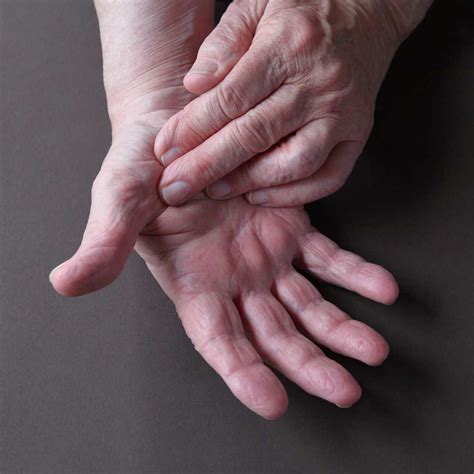 What are the Warning Signs and Symptoms of Neuropathy?