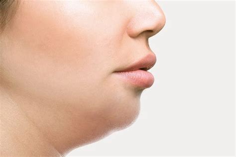 Double Chin Jowl Reduction Treatments Body Renewal