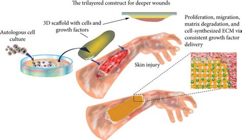 Schematic Illustrating The Stages Of Skin Tissue Engineering Using