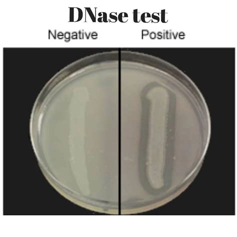 Dnase Test Agar Principle Interpretation