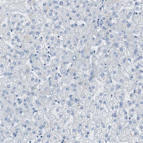 Rabbit Polyclonal Anti Rps Antibody Buy For Research Highly