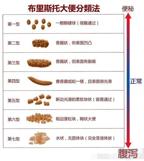 婴儿3天不拉大便正常吗（宝宝三天没有便便了） 幼儿百科 魔术铺