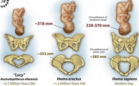 COMO LA PELVIS HUMANA VA EVOLUCIONANDO PARA EL PARTO