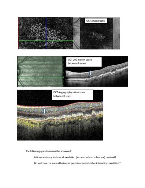 OCT ANGIOGRAPHY