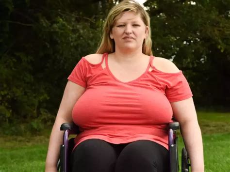 Womans Breasts Caused Spine Collapse