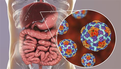 Hepatitis A S Ntomas Causas Y Tratamiento Medicina B Sica