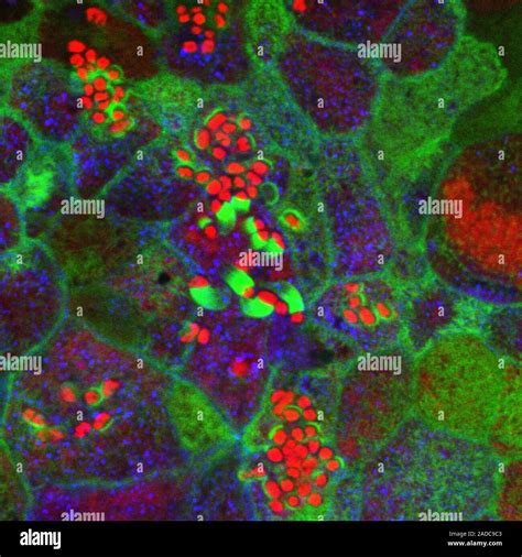 La Bacteria E Coli En El Intestino Delgado Micrograf A De Luz