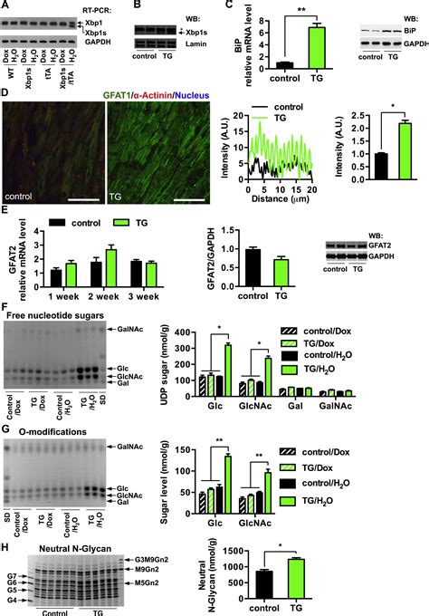 Spliced X Box Binding Protein 1 Couples The Unfolded Protein Response