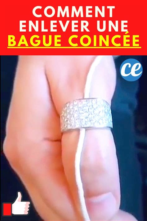 L Astuce D Un Bijoutier Pour Enlever Une Bague Coinc E Sans Vous Faire