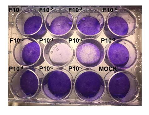 Please Provide Some Suggestions The Plaque Assay Of Influenza Virus Has Not Produced Plaque