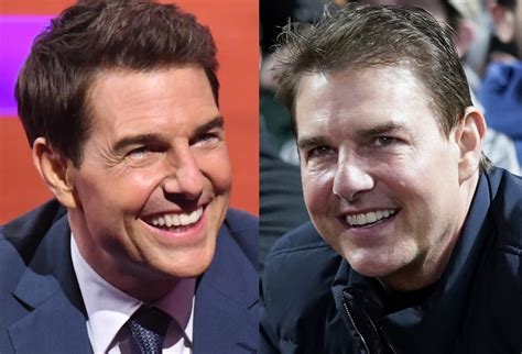 Tom Cruise El Antes Y El Despu S De Los Retoques Est Ticos De Las