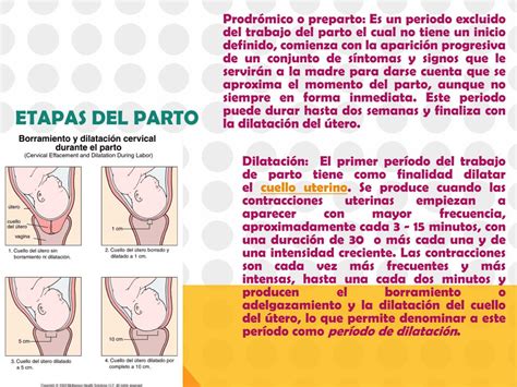 Ppt El Parto Powerpoint Presentation Free Download Id3632179