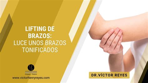 Lifting De Brazos Transforma Tus Brazos Con Braquioplastia Y Luce