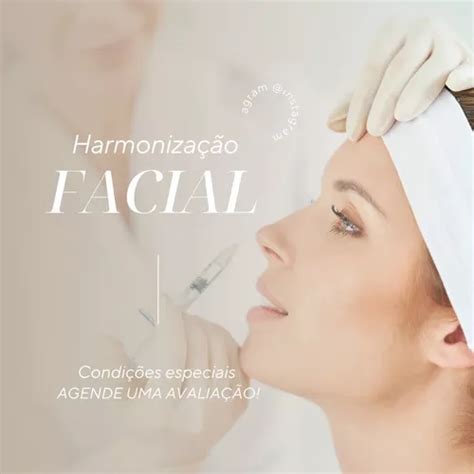 Pack Canva Odontologia Harmoniza O Facial Artes Edit Vel Venda Em