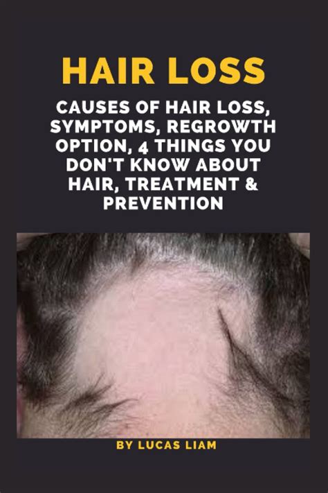 Hair Loss Causes Of Hair Loss Symptoms Regrowth Option 4 Things You