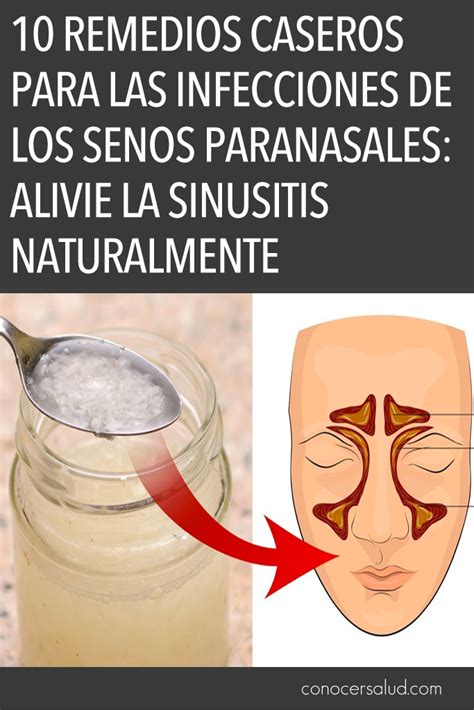 10 Remedios Caseros Para Las Infecciones De Los Senos Paranasales