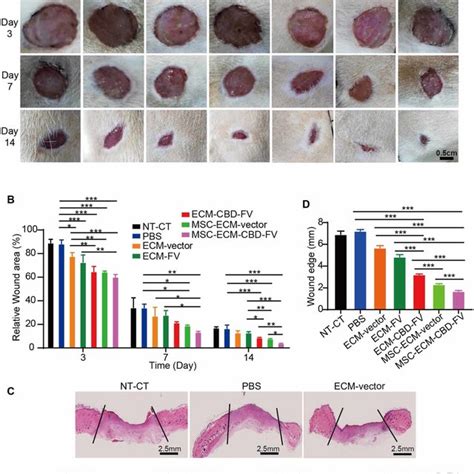 Effects Of Different Kinds Of Ecm Mixed With Hucmscs On Wound Healing