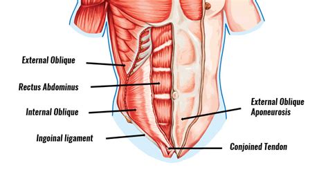 Inguinal Disruption (Gilmore's Groin) - Symptoms, Causes, Treatment ...