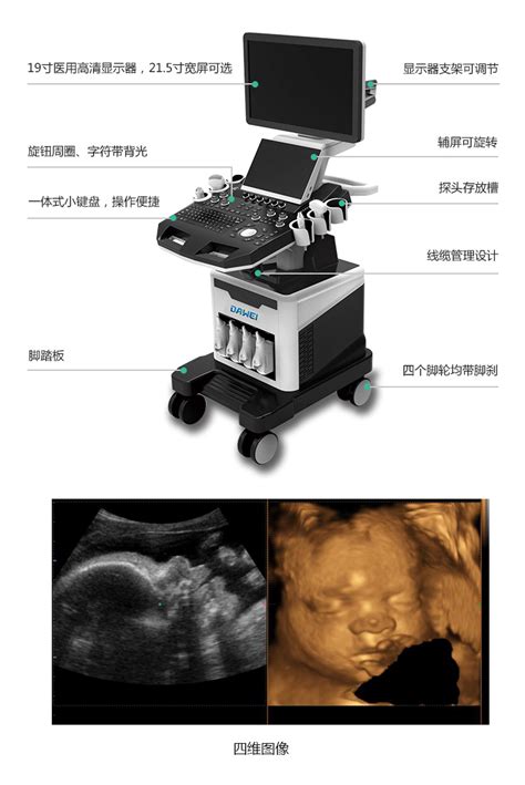 四维彩超报告单怎么看四维超机厂家 大为医疗 大为医疗