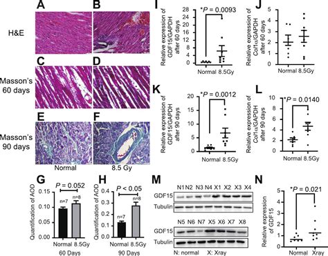 Gdf15 Promotes Cardiac Fibrosis And Proliferation Of Cardiac Fibroblasts Via The Mapk Erk1 2