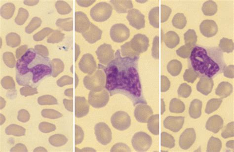 Monocytes Cells And Smears