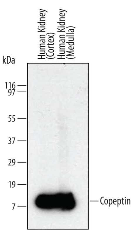 Human Copeptin Antibody R D Systems 100ug Unlabeledantibodies