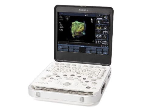 Philips CX50 – The Ultrasound Source