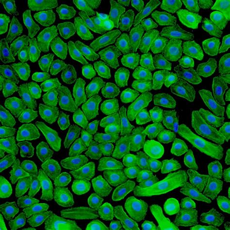 Human Epidermal Keratinocytes - Innoprot Dermal Cell System